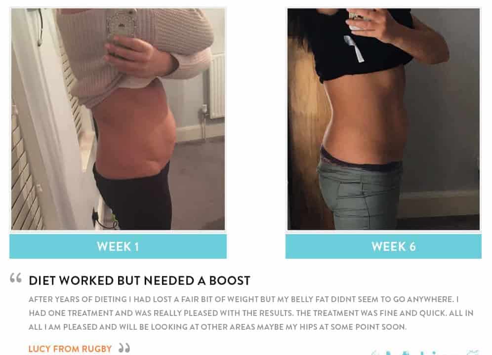 Before and After Dieting Ellesmere Port
