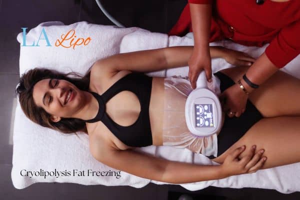 woman getting cryolipolysis Ellesmere Port