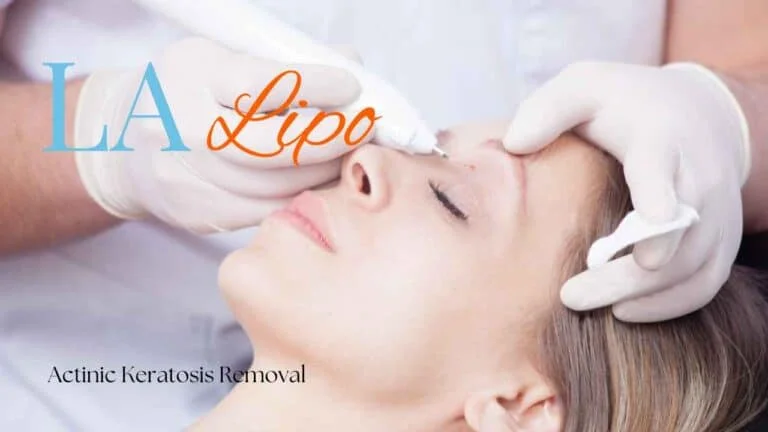 Woman receiving Actinic Keratosis Removal Treatment Ellesmere Port