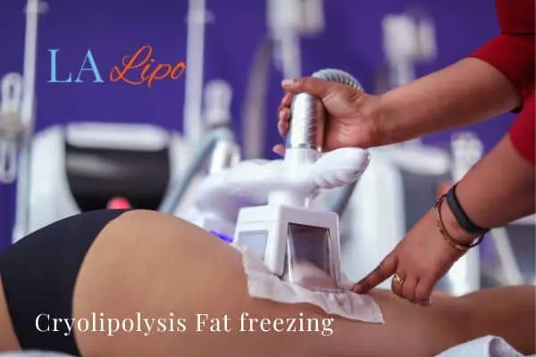 women getting fat freezing Ellesmere Port