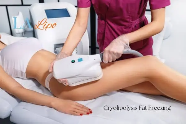 Woman receiving coolsculpting Ellesmere Port treatment on her thighs