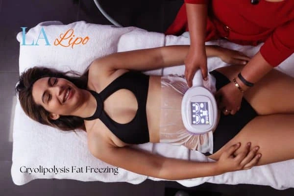 woman getting cryolipolysis Ellesmere Port