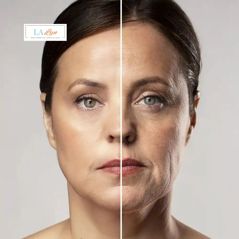 How Can You Tell If Non-Surgical Skin Tightening Is Right for You Ellesmere Port?