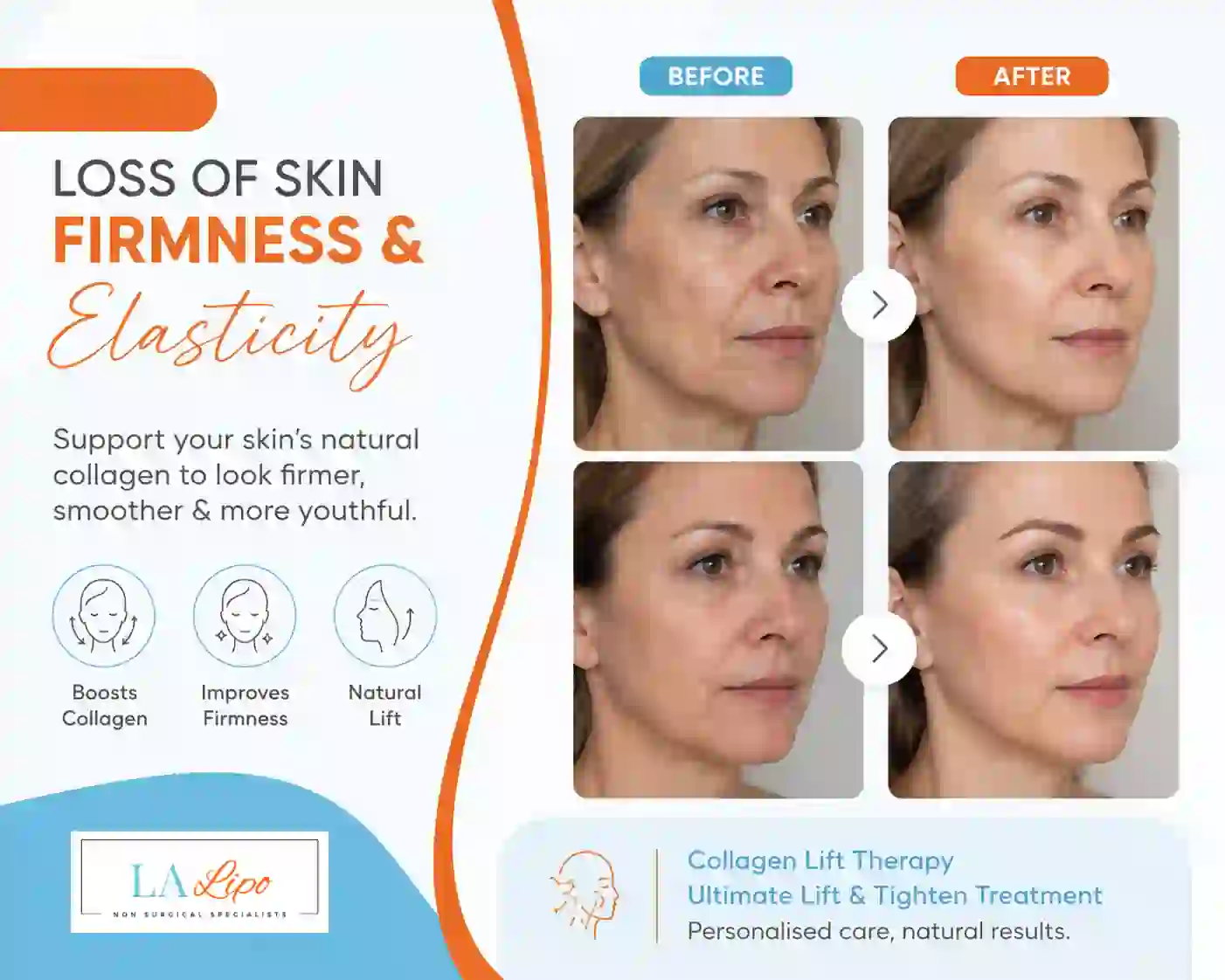 Sign #7: Loss of Skin Firmness and Elasticity Ellesmere Port