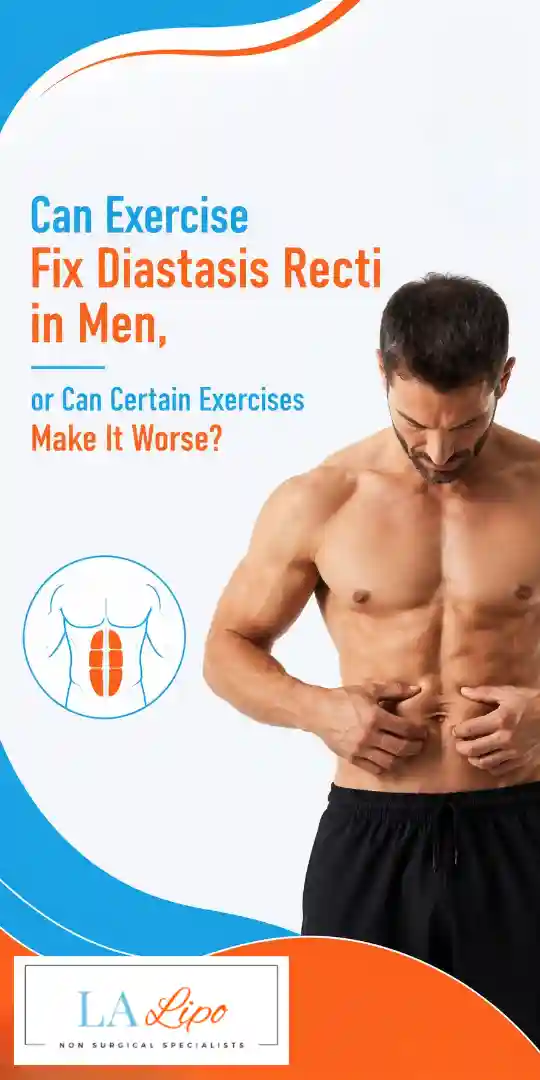 Can Exercise Fix Diastasis Recti in Men, or Can Certain Exercises Make It Worse Ellesmere Port?